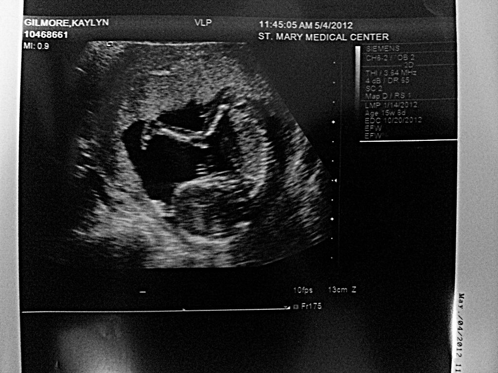 Baby Ultrasound Funny Quotes. QuotesGram